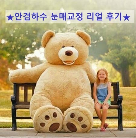안검하수 눈매교정 후기(+쌍커풀,현실후기,광고 x)