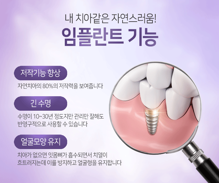 분당 임플란트 관리만 잘하면 오래 사용할 수 있어요.