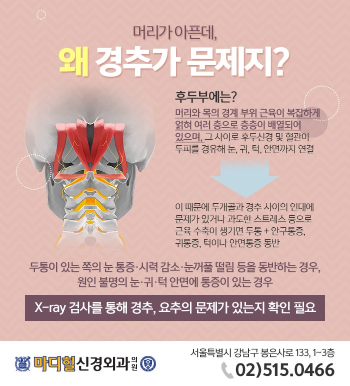 왼쪽 등 머리 통증의 원인과 치료법을 알아보세요 2