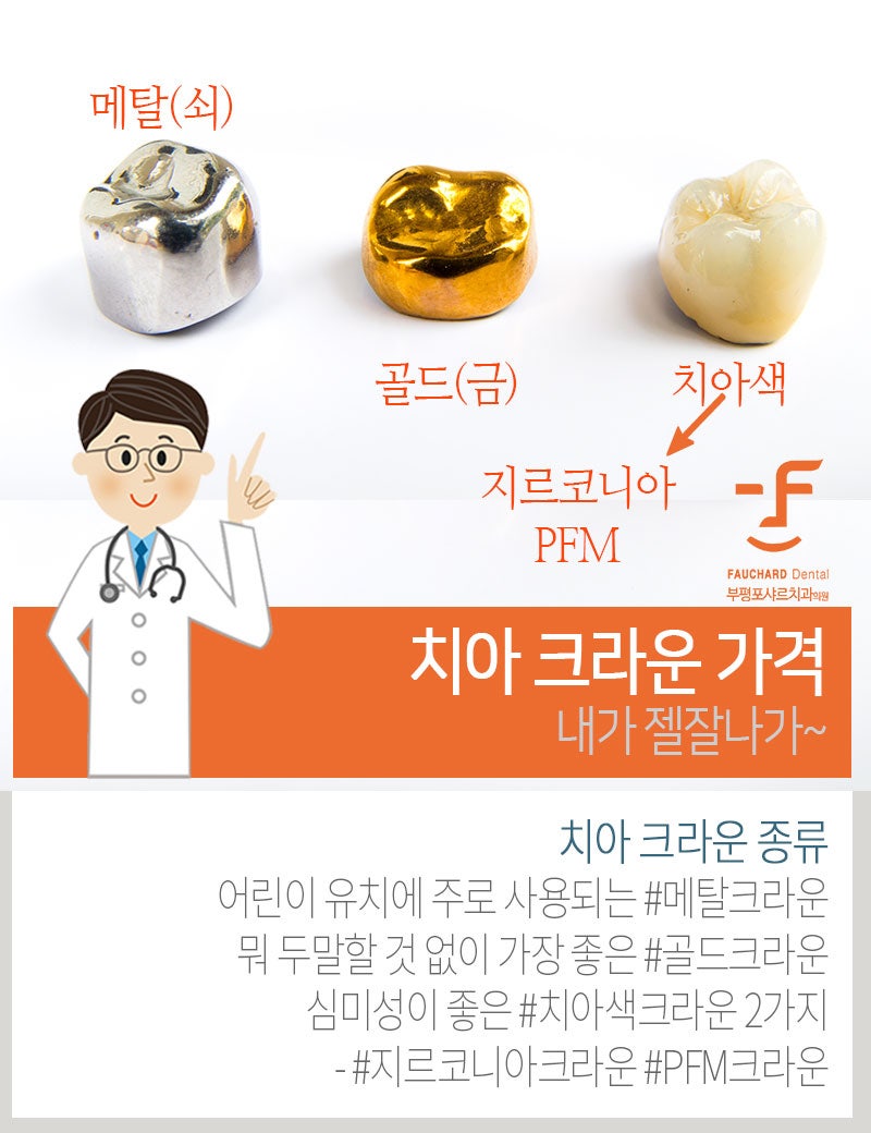 치아크라운가격 먼저 따져본다면 6