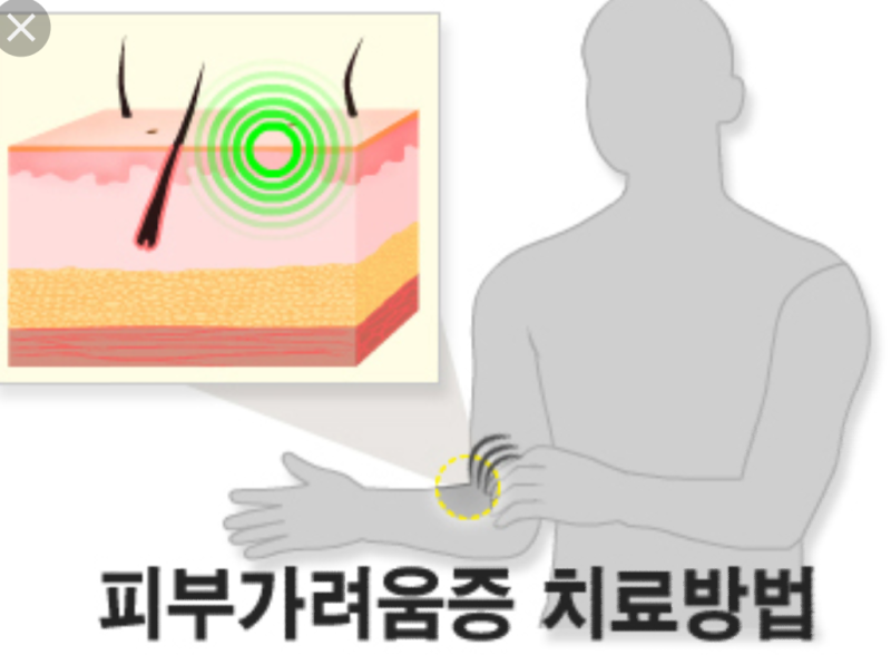 탱자효능 지긋지긋한 가려움#에 도움이..