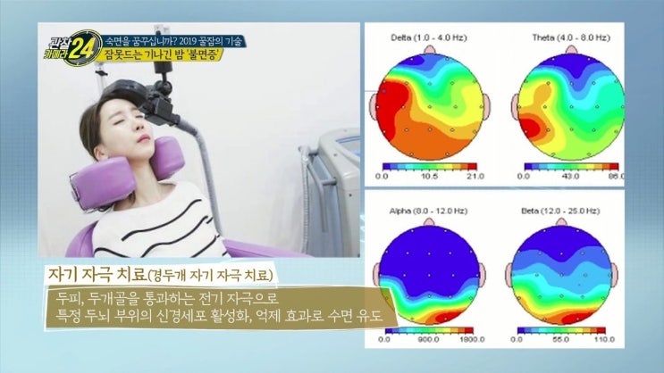 관찰카메라 24시간 불면증 해결 꿀잠의 기술 