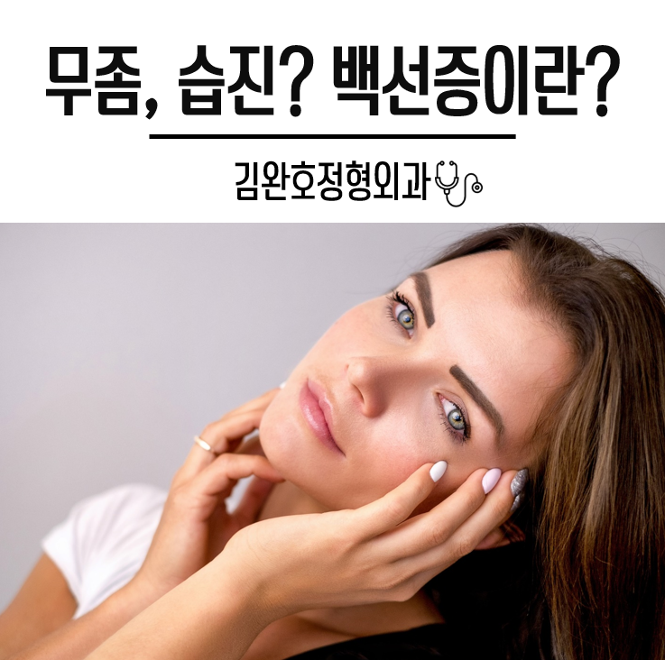무좀인가 습진인가? 피부병 백선증이란? : 네이버 블로그
