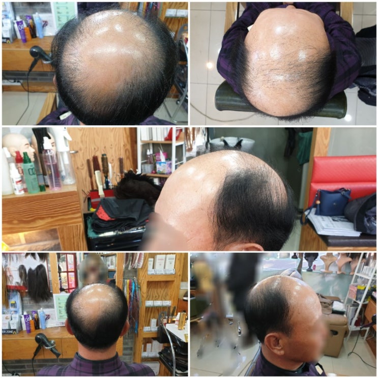  춘천가발 김호증모 남자맞춤가발 춘천가발전문점 이은주헤어살롱에 오신 걸 환영합니다 ^^