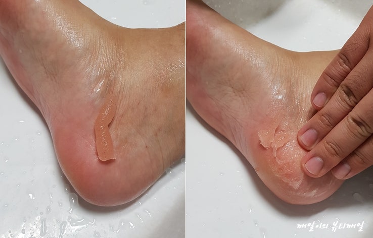 발 각질제거 첫 리뷰 성공!