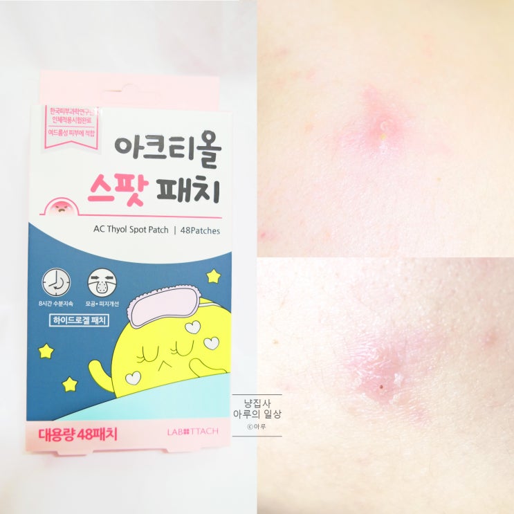  올리브영 추천/신제품 하트모양 여드름패치 솔직후기