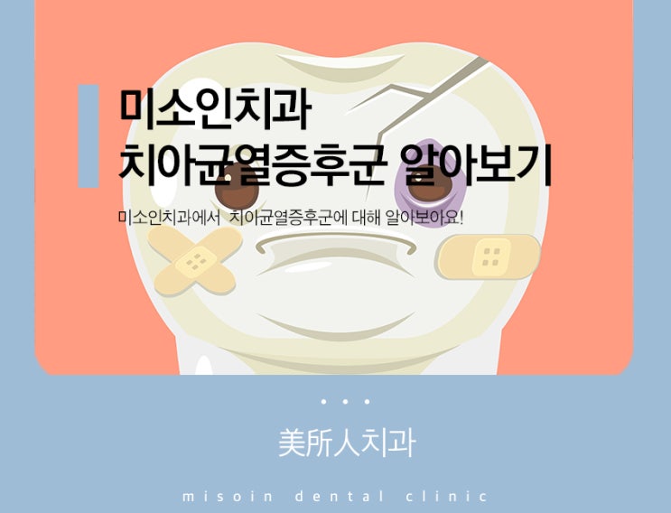  대치동치과추천, 미소인치과에서 치아균열증후군 알려드릴게요 :)