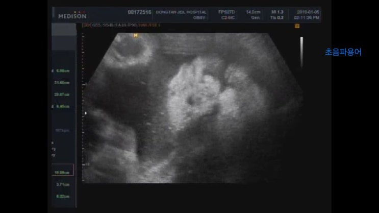 [임신35주] 동탄제일병원막달검사+화성시 정부지원 산후도우미신청, 환도선다