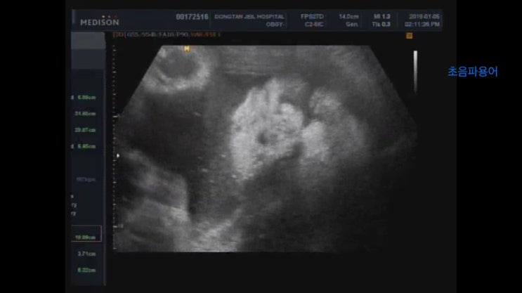  [임신35주] 동탄제일병원막달검사+화성시 정부지원 산후도우미신청, 환도선다
