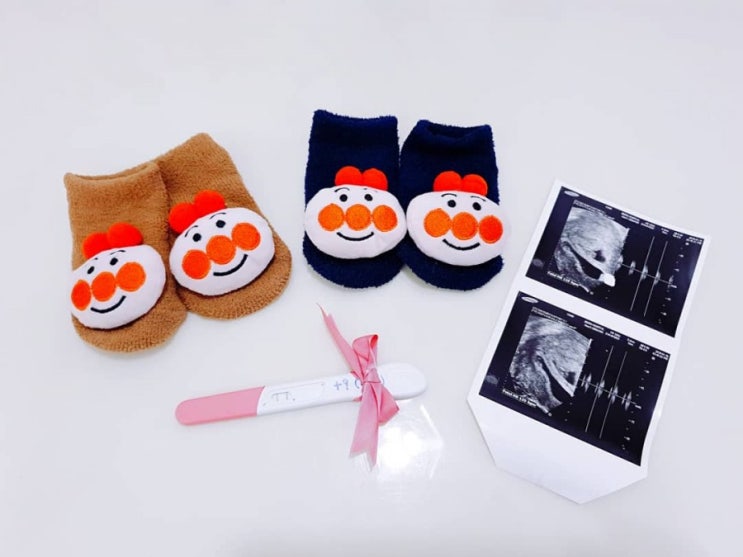  심장소리를 듣다:) #태명룰루랄라 #쿵쾅쿵쾅 #내마음도두근두근 #쌍둥이맘