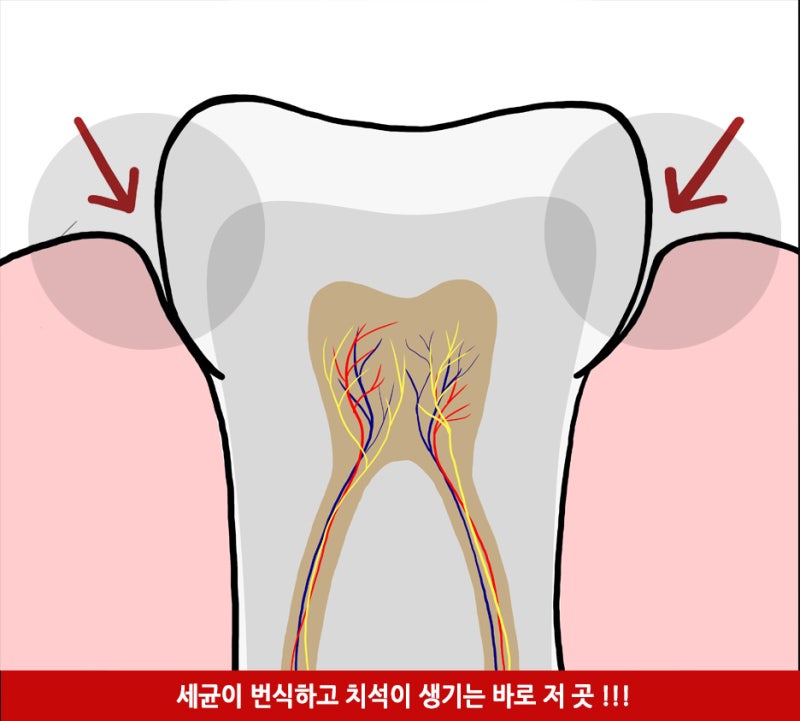 치과 의사가 알려주는 올바른 칫솔질 방법_올바른 양치질 방법 사진 2