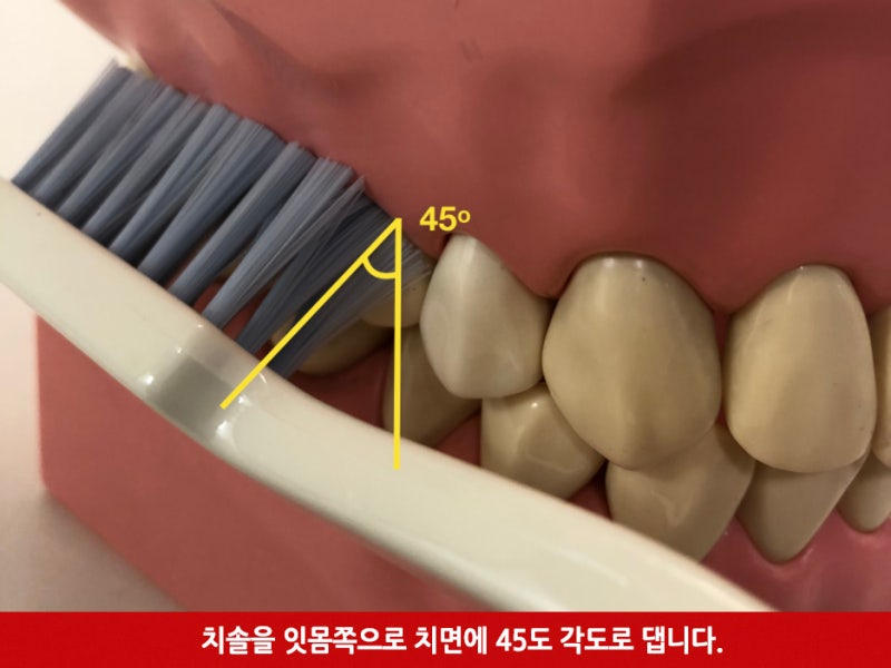 치과 의사가 알려주는 올바른 칫솔질 방법_올바른 양치질 방법