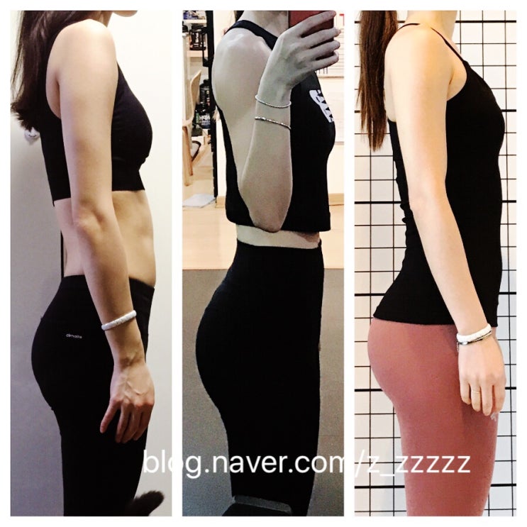  필라테스_척추전만증/lordosis