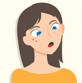 얼굴에 종기 나는 꿈(얼굴에 두드러기 나는 꿈, 두드래기 나는 꿈, 종기꿈, 피부병꿈, 피부 두....