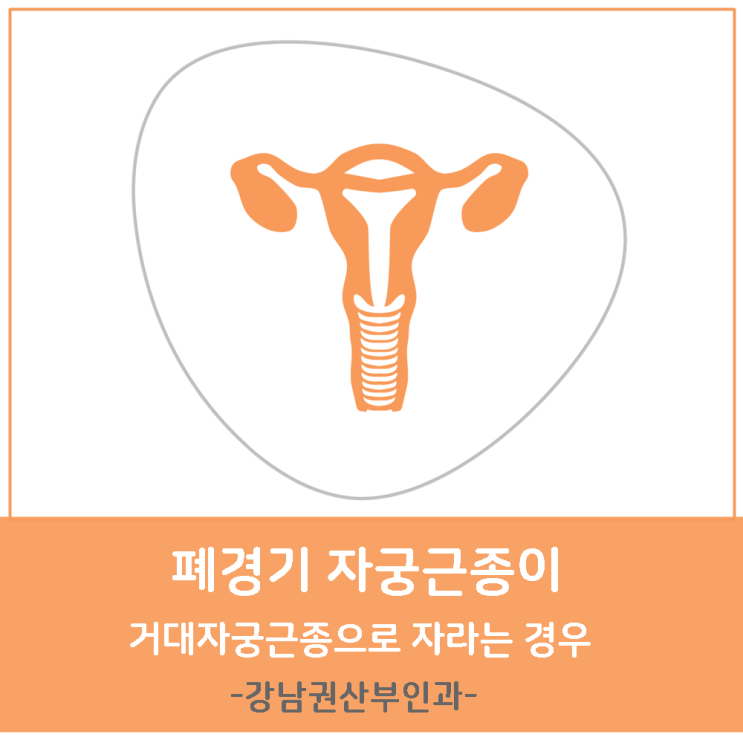  폐경기 자궁근종 이 거대자궁근종으로 자라는 경우