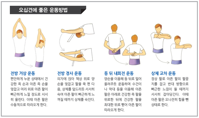 대전오십견치료 보존적인 방법을 적용하여