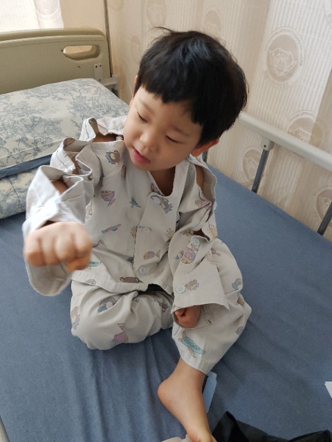  설소대 수술