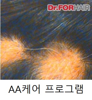 AA 케어 프로그램 AA 케어 프로그램