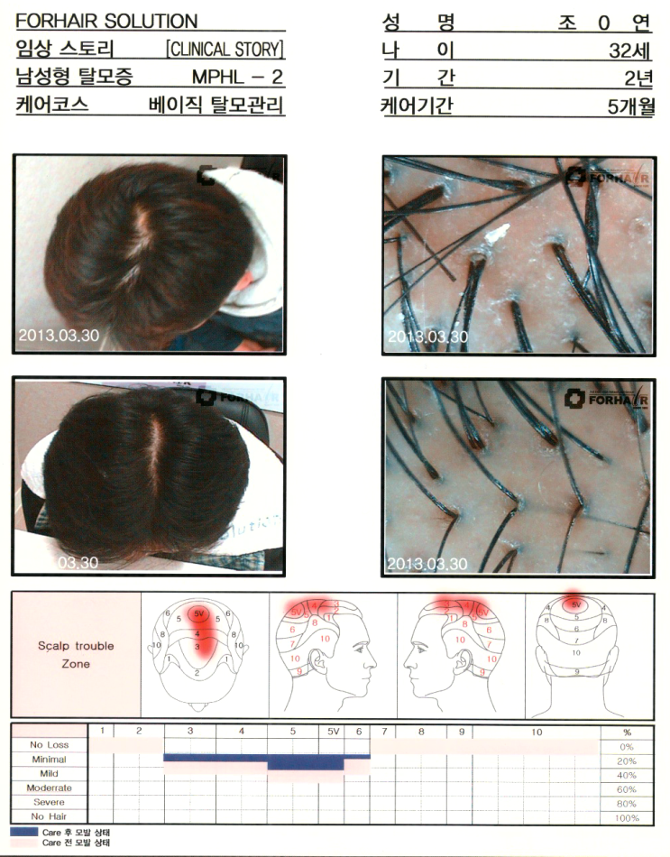 모발 좋아지는 팁!