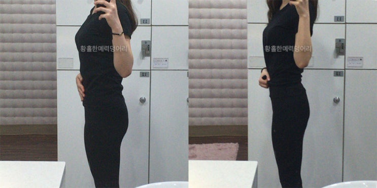 <습관 성형 마이다노> 미니스커트 챌린지 솔직 후기 (사진有)