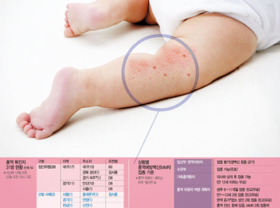  번지는 '홍역' 공포···설 연휴 '고역'되나