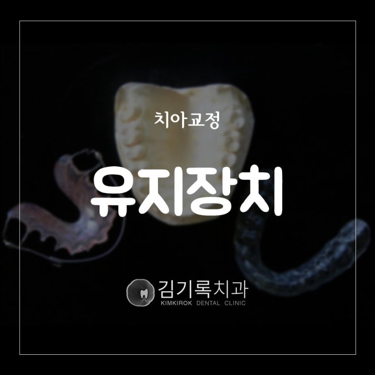 수원치아교정잘하는곳 후 교정 후 유지장치 꼭 해야 하나요? 얼마 동안 끼어야 하나요? 교정유지장치 장착 기간