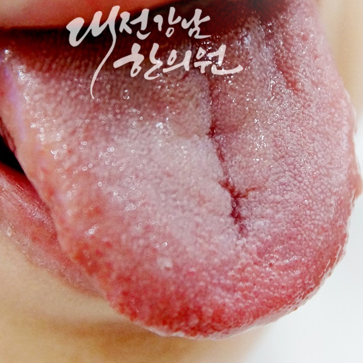  혓바닥 갈라짐 유형 - 혓바닥이 갈라지는 이유 혀가 갈라지는 이유 균열설