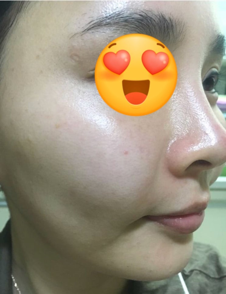  이루틴 MTS 오늘 마감이예요 단 2회만 써도 나오는 효과 , 8회 쓰면 어떨지..