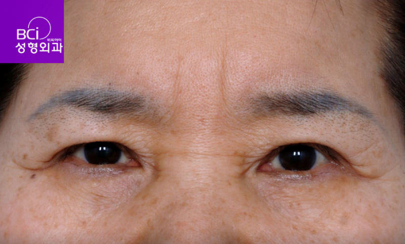 이마거상술후기 6년 넘은 5