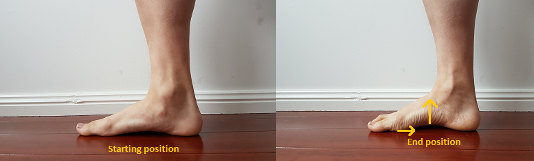 X다리! knee valgus pattern 재활에 대해 알아봅시다! : 네이버 블로그