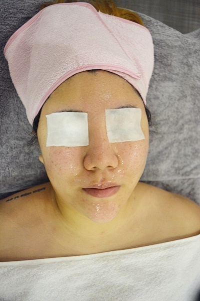 용인피부관리 잘하는곳 헤라스킨케어 구갈동 추천! 나으 아름다운 여드름피부 조지고왔어요 -약초필,트로이필