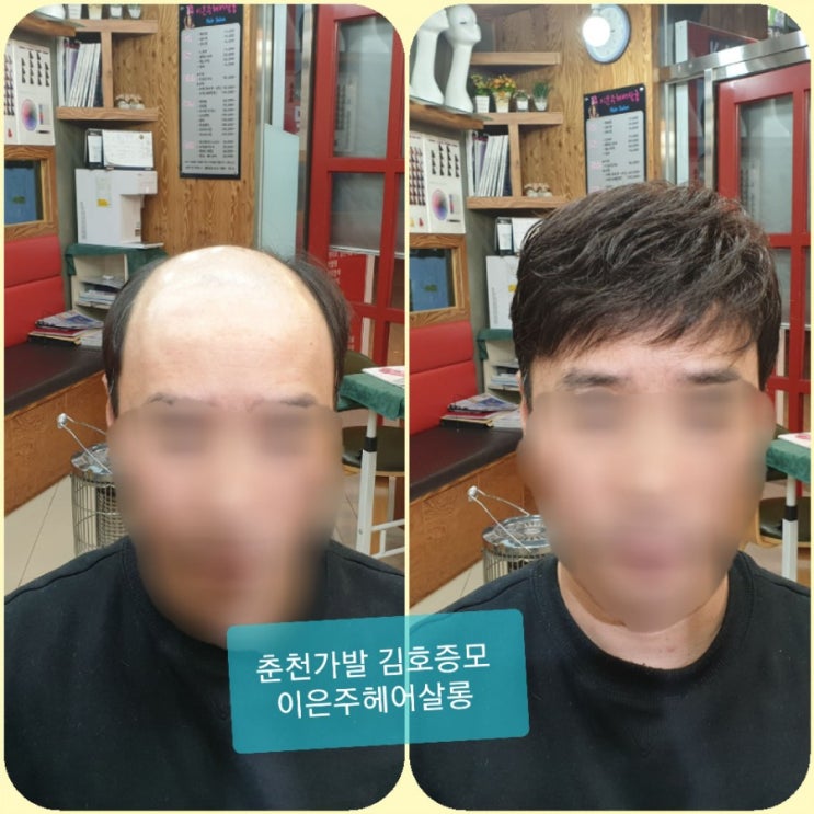  춘천가발 김호증모 춘천가발전문점 남자맞춤가발 파마로 스타일 정비하고 갑니다~^^
