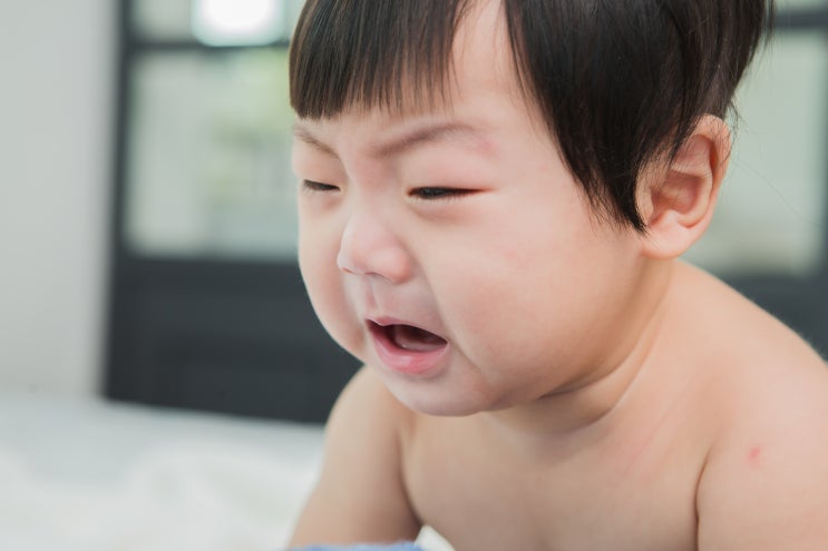 앙쥬 1월호 | 생후 37개월 눈 흰자에 빨간점이 생겼어요! 비앤빛 김정섭 안과전문의 도움말