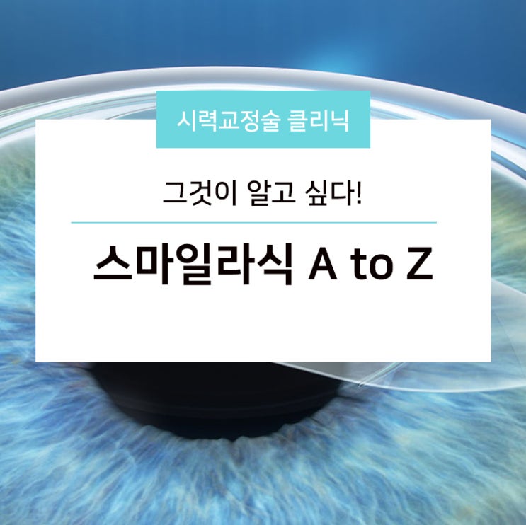  그것이 알고 싶다! 스마일라식 A to Z