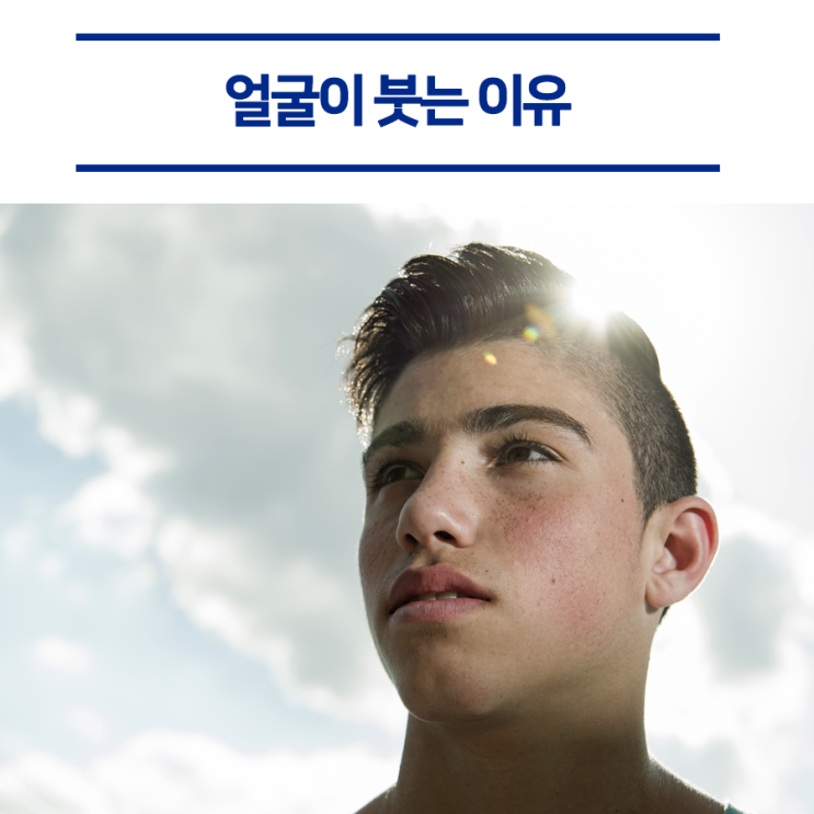  아침마다 얼굴이 붓는 이유, 뭐 때문일까?