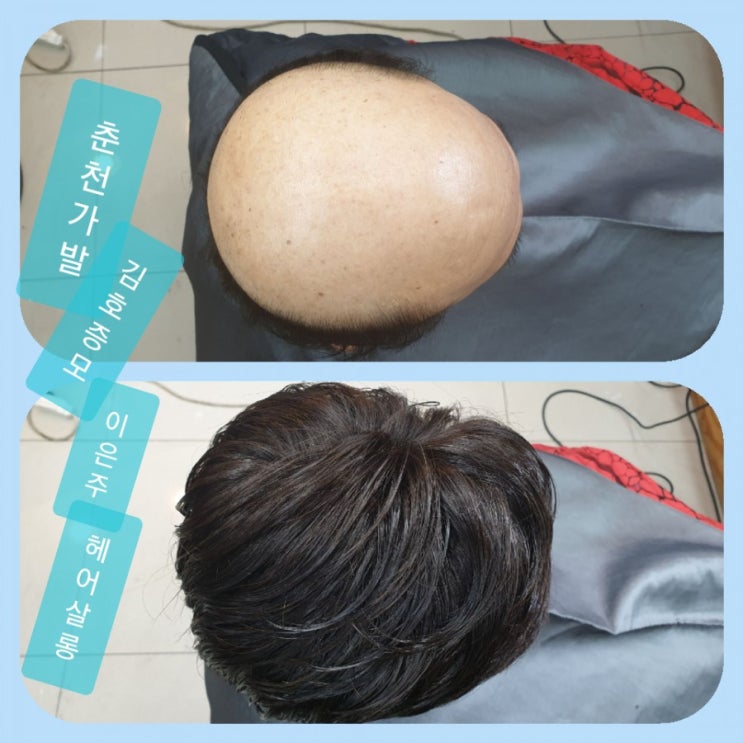  춘천가발 김호증모 남자맞춤가발전문점 고정식가발 관리 받는날~^^