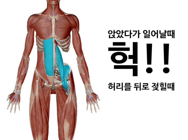 허리 삐끗했어요-요추 염좌(영통 새움한의원)