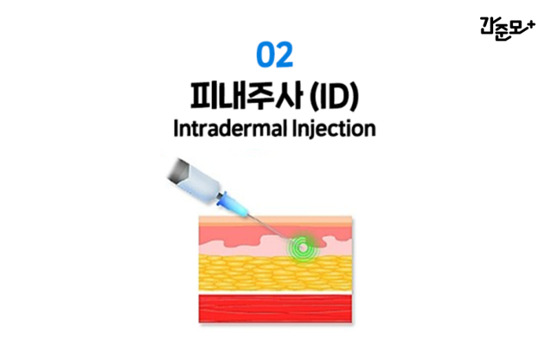 간호사 공부 - 주사 종류 총정리 (그림) : 네이버 블로그