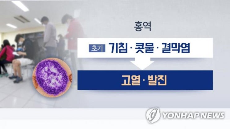  홍역 환자 20명으로 늘어, 전염성 높은 급성 발진성 질환…홍역 증상은 무엇?