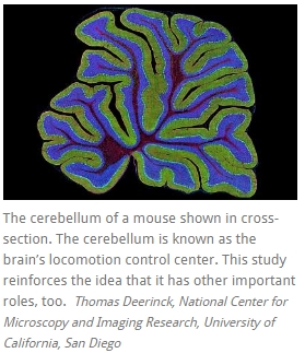 뇌의 보상 시스템과 연결된 소뇌