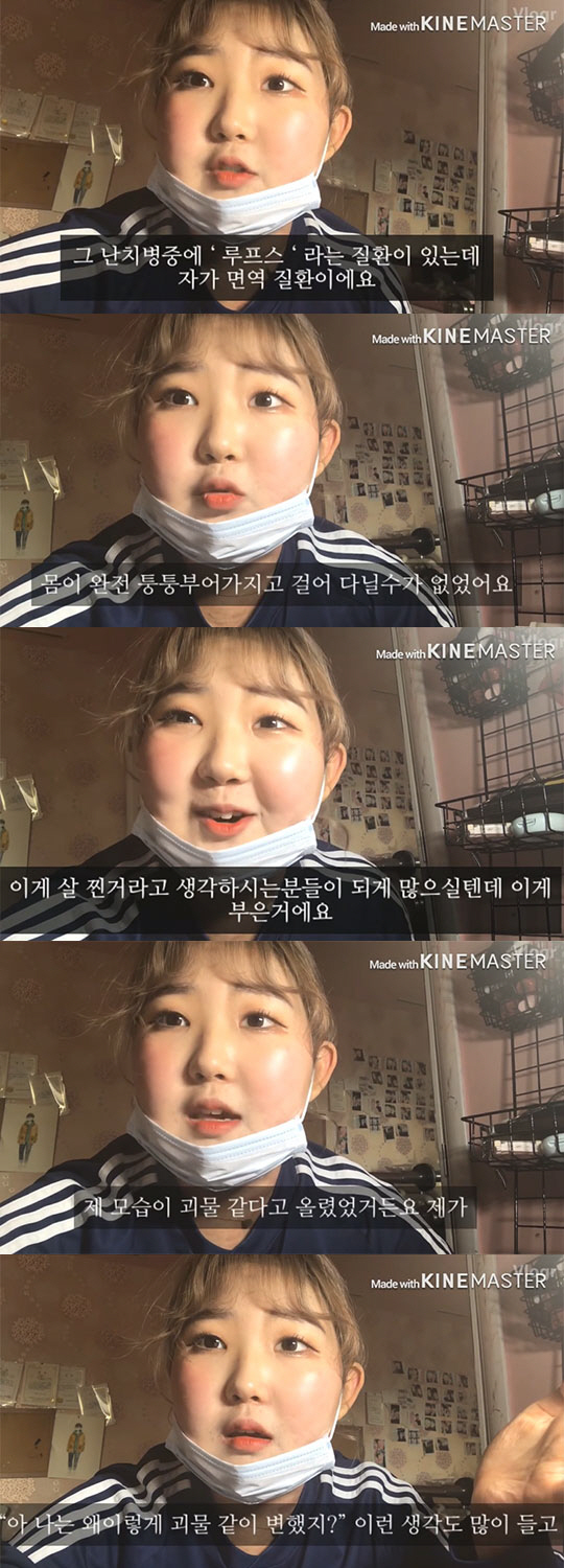  최준희 루프스병 고백 유튜버로 근황