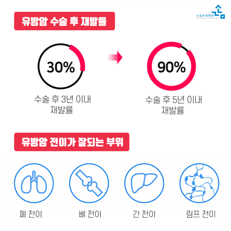 유방암 원인 림프 전이 재발 예후 방안