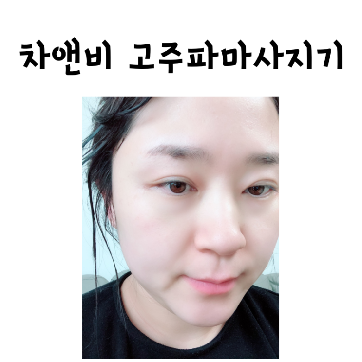  차앤비 가정용고주파 일주일 사용후기