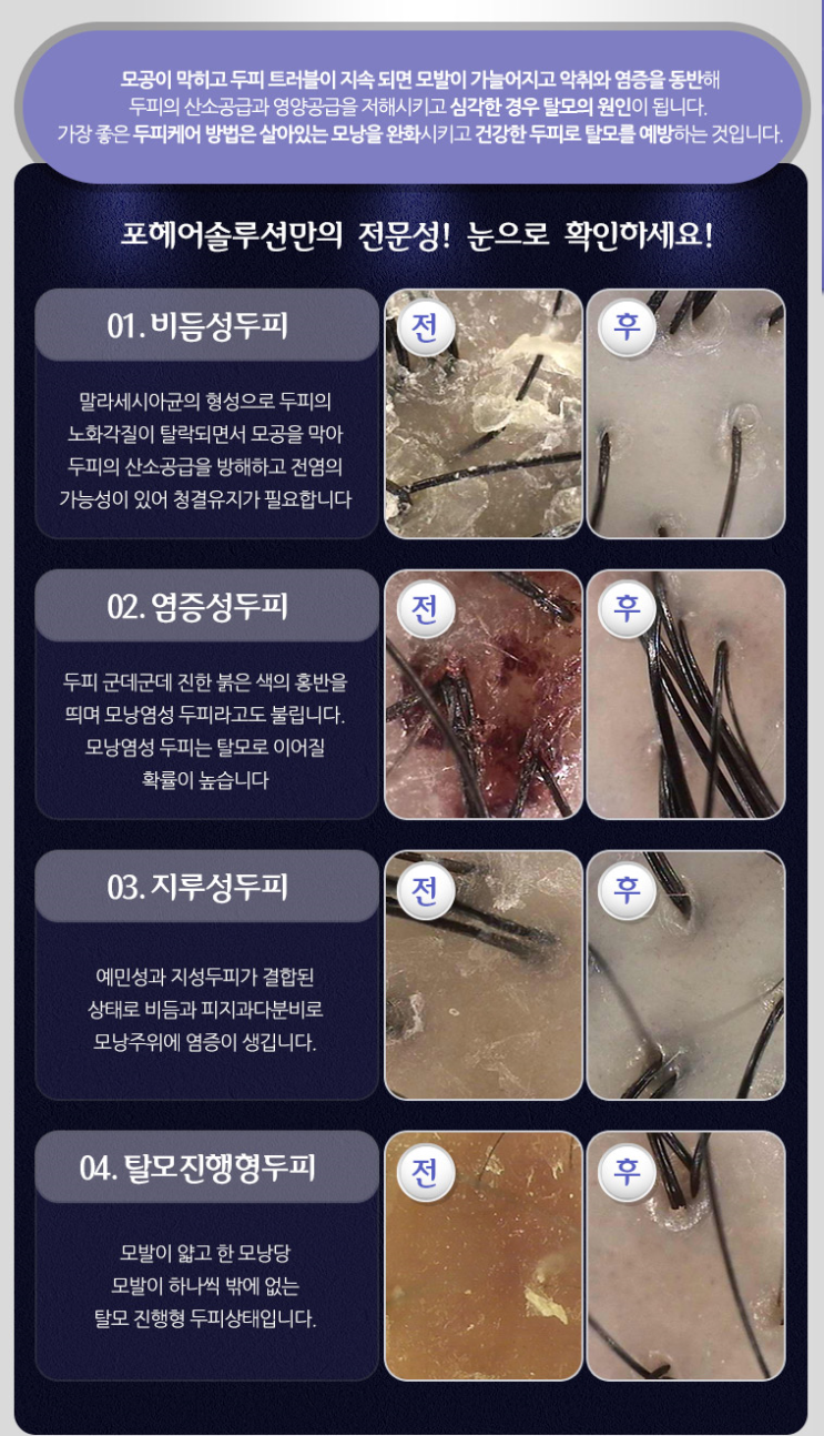  강서구에 있는 닥터포헤어