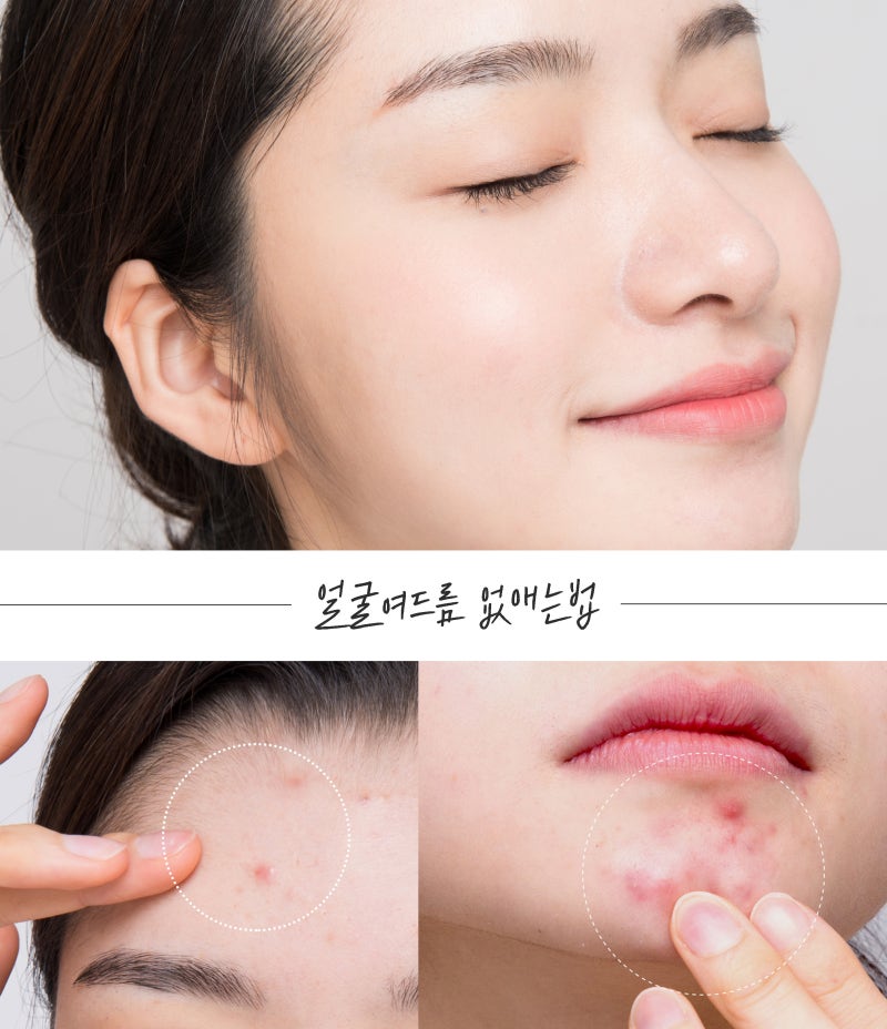 얼굴 얼룩 없애는 방법 정답 찾았어요!