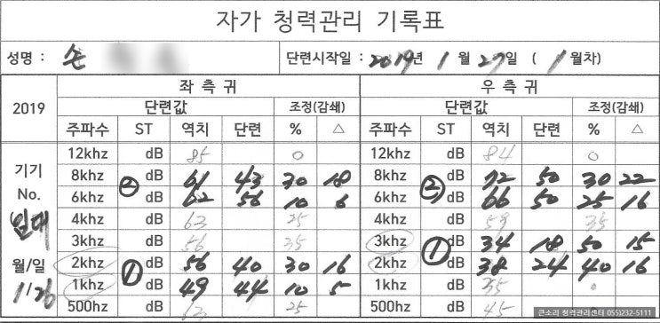  청력개선 (69세 남) 손OO님 (2019.01.26 ~2019.02.09)