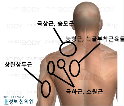  내 어깨통증은 무엇일까?(1) 오십견에 대해 알아봅시다