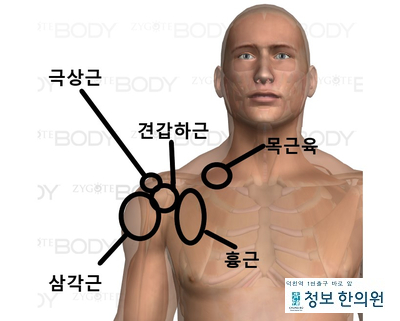  내 어깨통증은 무엇일까?(2) 어깨 통증의 1번 주자! 극상근.