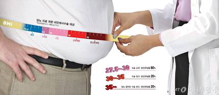 비만수술-대사수술 건강보험 본인부담률 다른 이유 비만수술-대사수술 건강보험 본인부담률 다른 이유