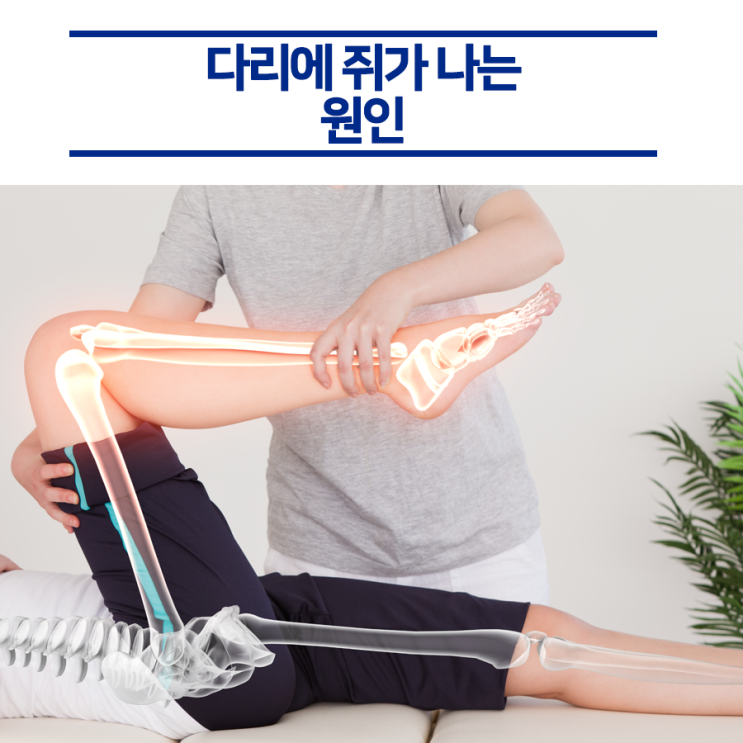  빈번하게 다리에 쥐가 나는 원인은?!
